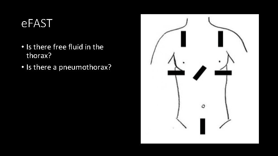 e. FAST • Is there free fluid in the thorax? • Is there a