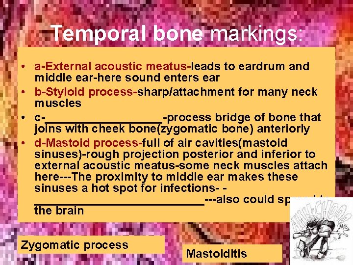 Temporal bone markings: • a-External acoustic meatus-leads to eardrum and middle ear-here sound enters