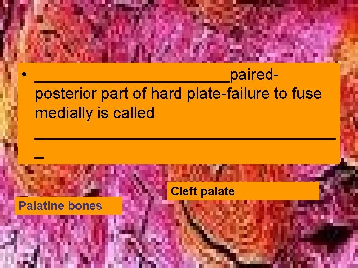  • ___________pairedposterior part of hard plate-failure to fuse medially is called _________________ _