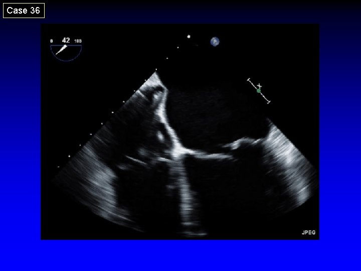 Case 36 