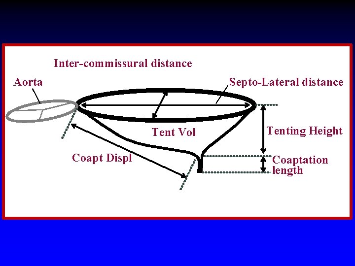 Inter-commissural distance Aorta Septo-Lateral distance Tent Vol Coapt Displ Tenting Height Coaptation length 