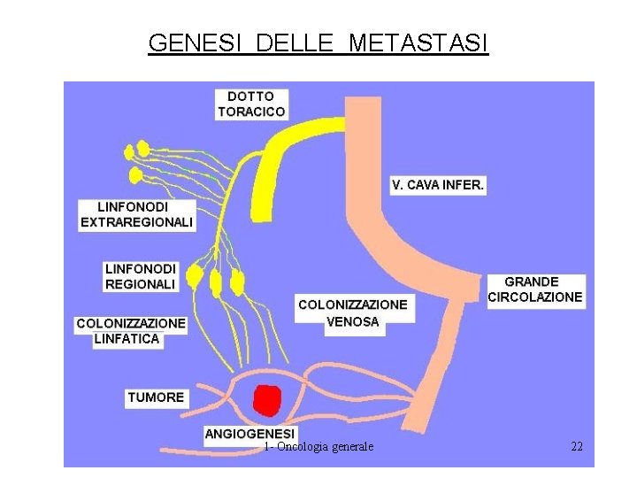 GENESI DELLE METASTASI 1 - Oncologia generale 22 