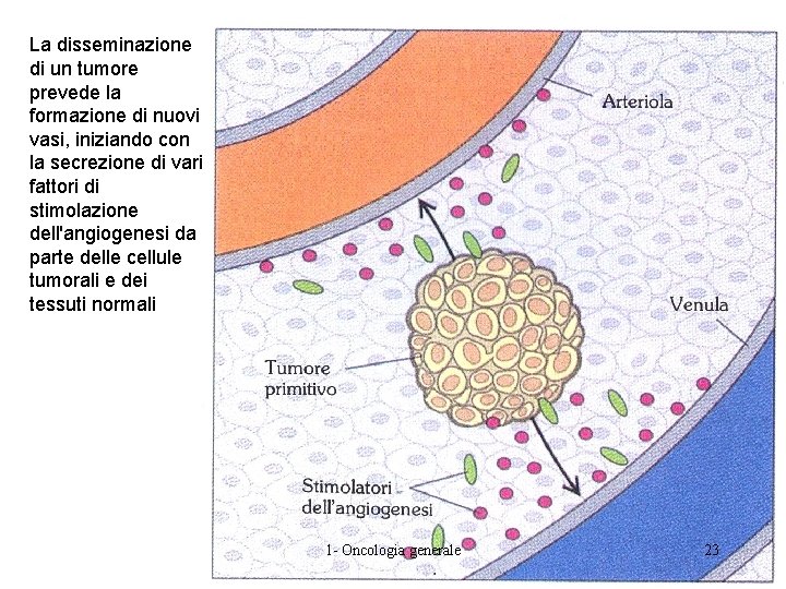 La disseminazione di un tumore prevede la formazione di nuovi vasi, iniziando con la