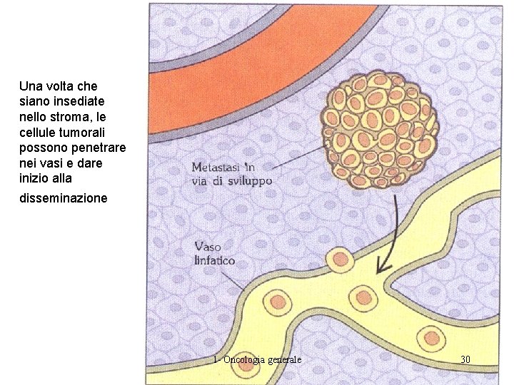 Una volta che siano insediate nello stroma, le cellule tumorali possono penetrare nei vasi