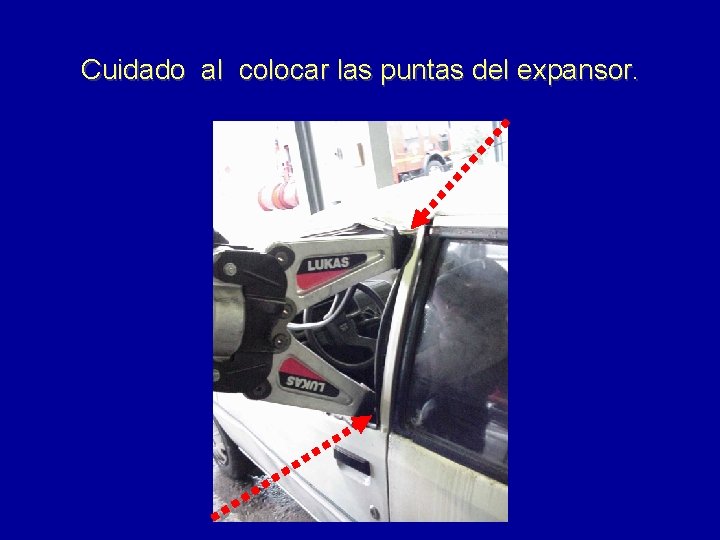 Cuidado al colocar las puntas del expansor. 