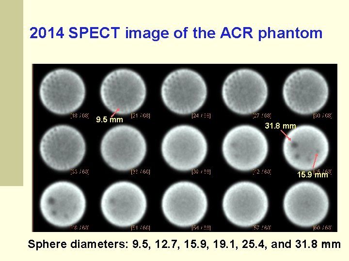 2014 SPECT image of the ACR phantom as 9. 5 mm 31. 8 mm