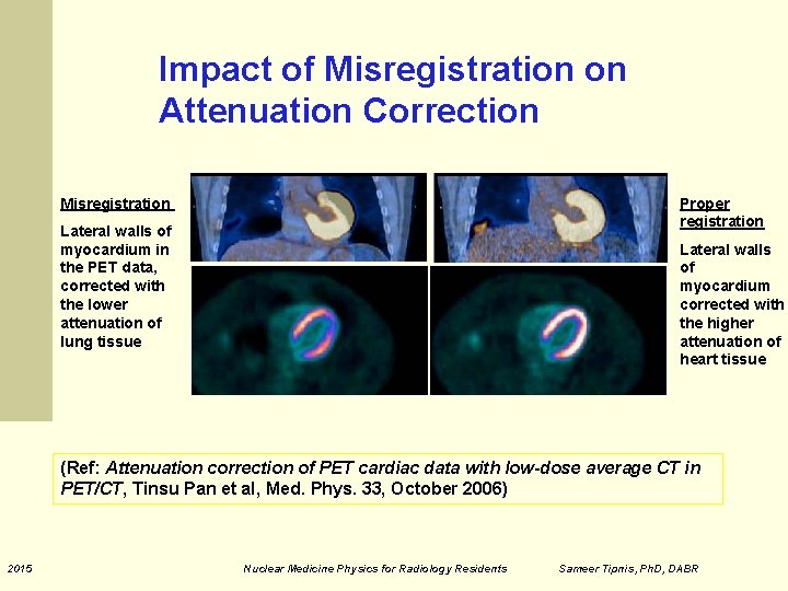 Impact of Misregistration on Attenuation Correction Misregistration Proper registration Lateral walls of myocardium in