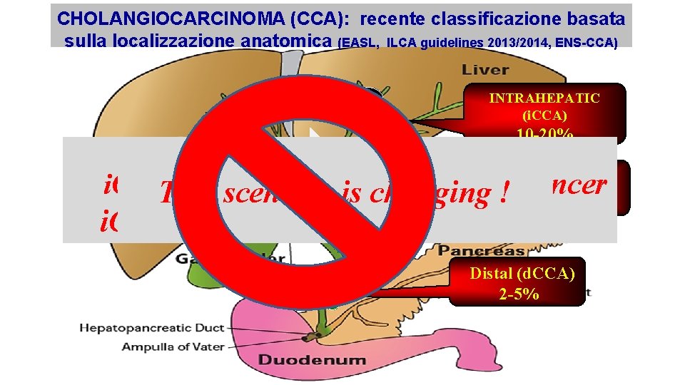 CHOLANGIOCARCINOMA (CCA): recente classificazione basata sulla localizzazione anatomica (EASL, ILCA guidelines 2013/2014, ENS-CCA) INTRAHEPATIC