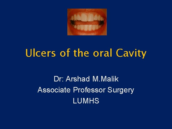 Ulcers of the oral Cavity Dr: Arshad M. Malik Associate Professor Surgery LUMHS 
