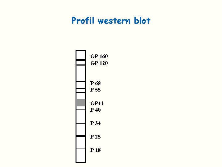 Profil western blot GP 160 GP 120 P 68 P 55 GP 41 P