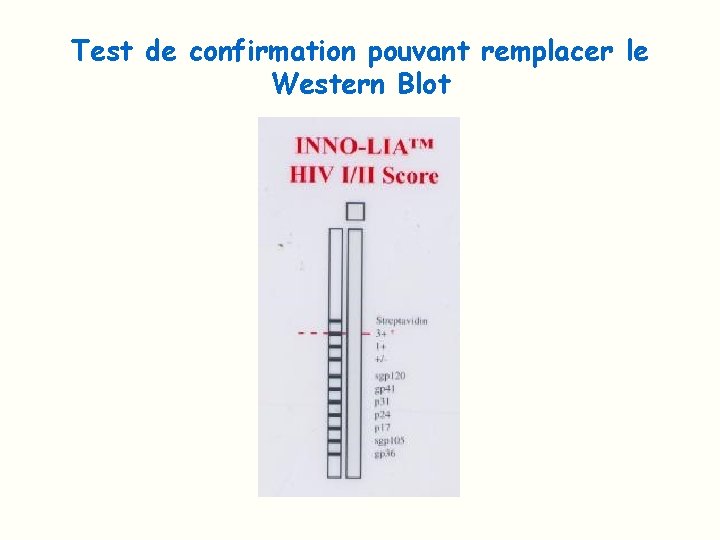 Test de confirmation pouvant remplacer le Western Blot 