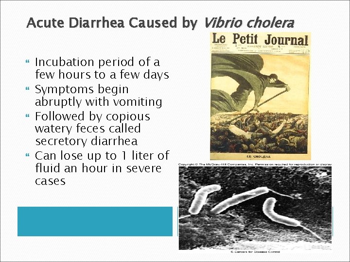 Acute Diarrhea Caused by Vibrio cholera Incubation period of a few hours to a