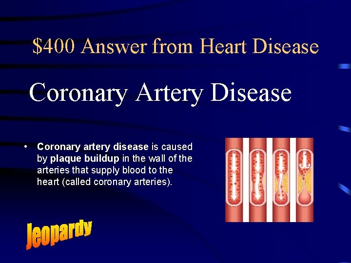 $400 Answer from Heart Disease Coronary Artery Disease • Coronary artery disease is caused