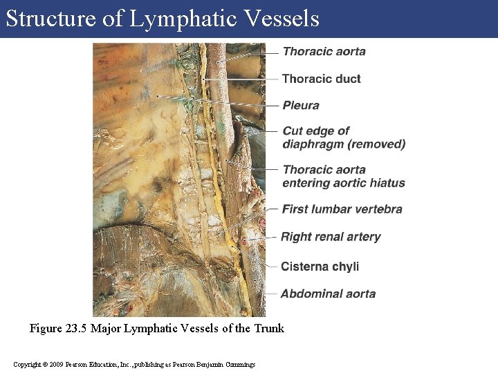 Structure of Lymphatic Vessels Figure 23. 5 Major Lymphatic Vessels of the Trunk Copyright Structure of Lymphatic Vessels Figure 23. 5 Major Lymphatic Vessels of the Trunk Copyright