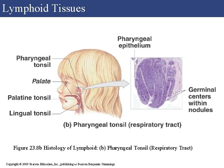 Lymphoid Tissues Figure 23. 8 b Histology of Lymphoid: (b) Pharyngeal Tonsil (Respiratory Tract) Lymphoid Tissues Figure 23. 8 b Histology of Lymphoid: (b) Pharyngeal Tonsil (Respiratory Tract)