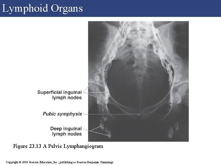 Lymphoid Organs Figure 23. 13 A Pelvic Lymphangiogram Copyright © 2009 Pearson Education, Inc. Lymphoid Organs Figure 23. 13 A Pelvic Lymphangiogram Copyright © 2009 Pearson Education, Inc.
