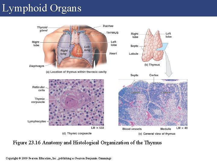 Lymphoid Organs Figure 23. 16 Anatomy and Histological Organization of the Thymus Copyright © Lymphoid Organs Figure 23. 16 Anatomy and Histological Organization of the Thymus Copyright ©