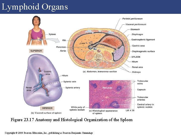 Lymphoid Organs Figure 23. 17 Anatomy and Histological Organization of the Spleen Copyright © Lymphoid Organs Figure 23. 17 Anatomy and Histological Organization of the Spleen Copyright ©