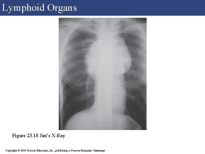 Lymphoid Organs Figure 23. 18 Jan’s X-Ray Copyright © 2009 Pearson Education, Inc. , Lymphoid Organs Figure 23. 18 Jan’s X-Ray Copyright © 2009 Pearson Education, Inc. ,