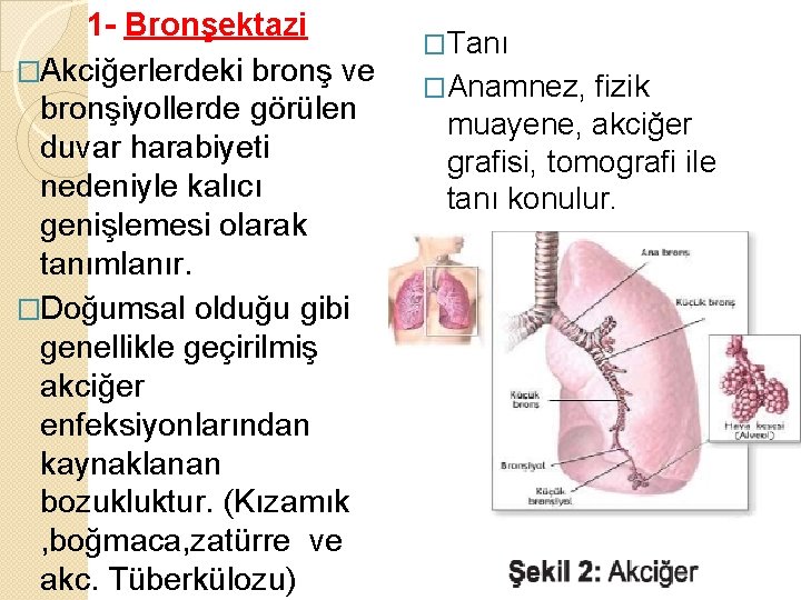 1 - Bronşektazi �Akciğerlerdeki bronş ve bronşiyollerde görülen duvar harabiyeti nedeniyle kalıcı genişlemesi olarak