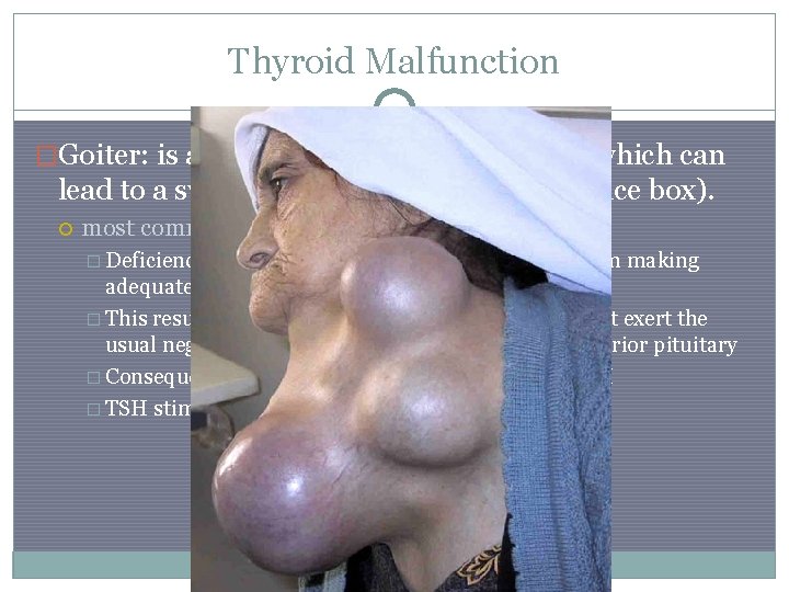 Thyroid Malfunction �Goiter: is a swelling in the thyroid gland, which can lead to