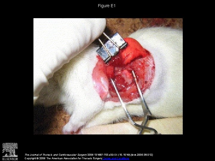 Figure E 1 The Journal of Thoracic and Cardiovascular Surgery 2006 131697 -703. e