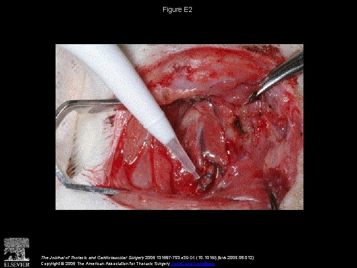 Figure E 2 The Journal of Thoracic and Cardiovascular Surgery 2006 131697 -703. e