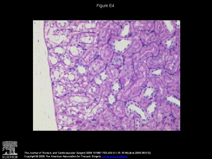 Figure E 4 The Journal of Thoracic and Cardiovascular Surgery 2006 131697 -703. e