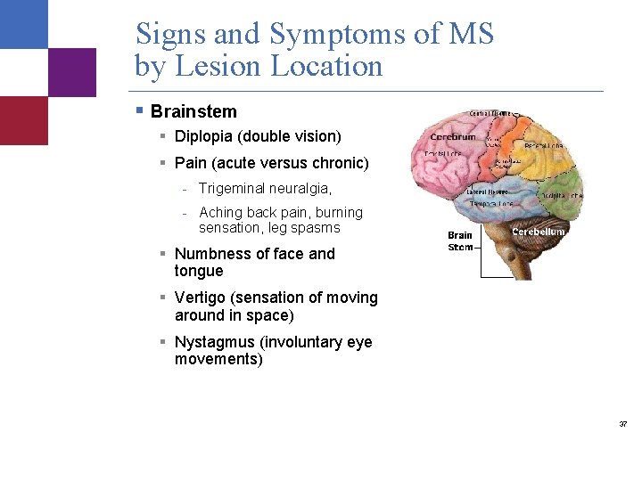 Signs and Symptoms of MS by Lesion Location § Brainstem § Diplopia (double vision)