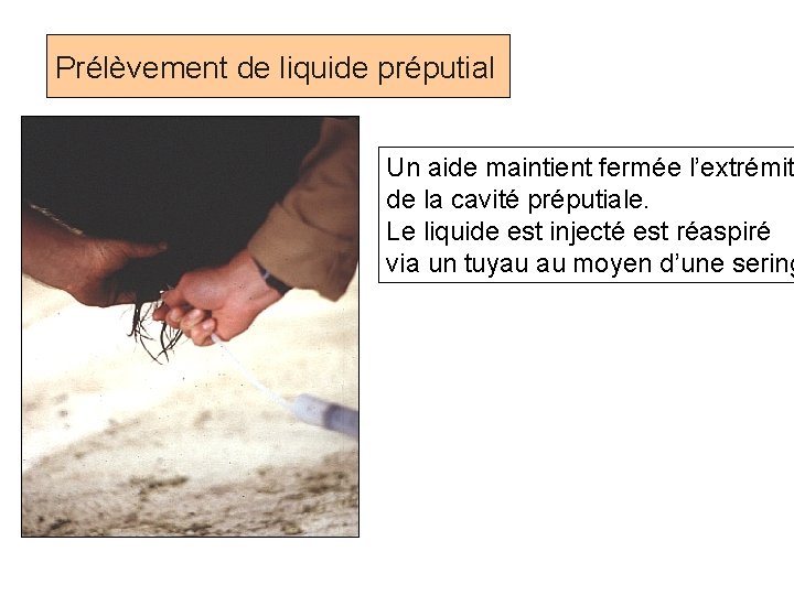 Prélèvement de liquide préputial Un aide maintient fermée l’extrémit de la cavité préputiale. Le