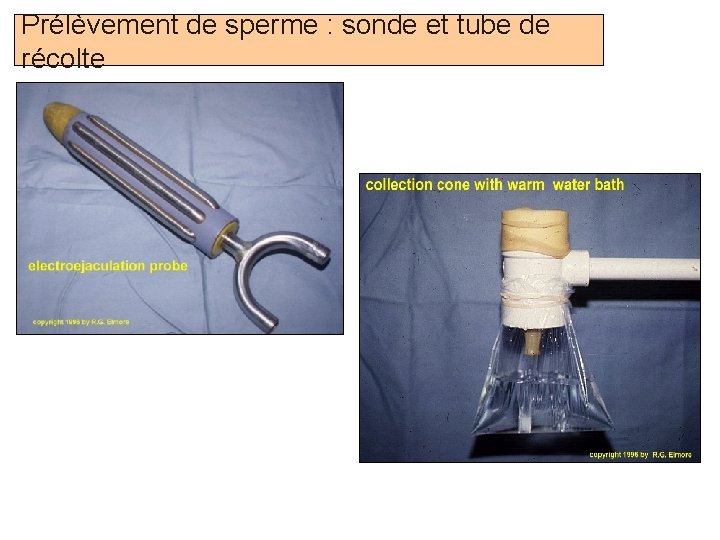 Prélèvement de sperme : sonde et tube de récolte Prof. Ch. Hanzen- Propédeutique de