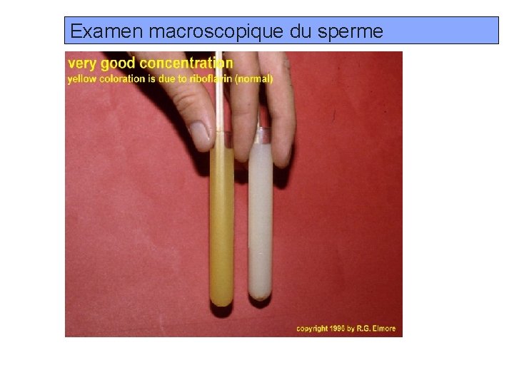 Examen macroscopique du sperme Prof. Ch. Hanzen- Propédeutique de l ’appareil génital mâle des