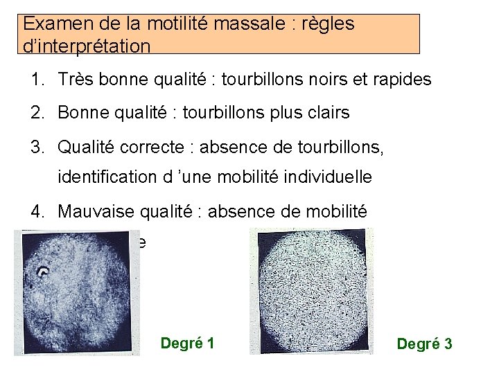 Examen de la motilité massale : règles d’interprétation 1. Très bonne qualité : tourbillons