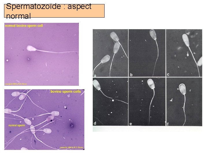 Spermatozoïde : aspect normal Prof. Ch. Hanzen- Propédeutique de l ’appareil génital mâle des