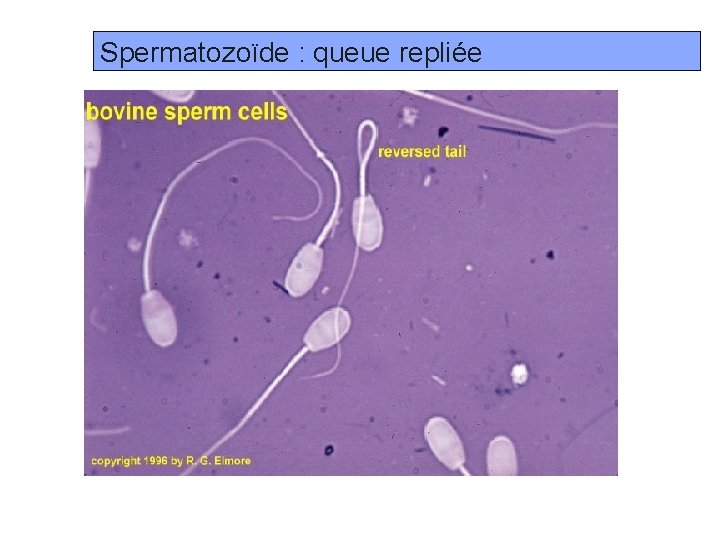 Spermatozoïde : queue repliée Prof. Ch. Hanzen- Propédeutique de l ’appareil génital mâle des