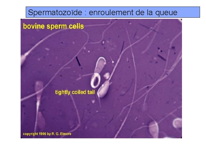 Spermatozoïde : enroulement de la queue Prof. Ch. Hanzen- Propédeutique de l ’appareil génital