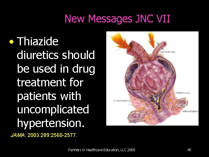 New Messages JNC VII • Thiazide diuretics should be used in drug treatment for