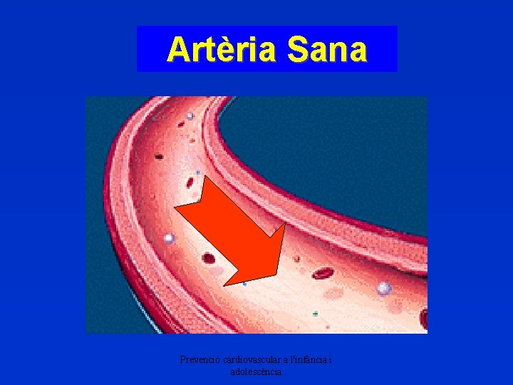 Artèria Sana Prevenció cardiovascular a l'infància i adolescència 