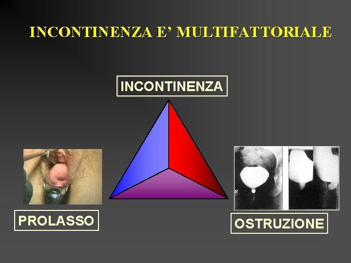 INCONTINENZA E’ MULTIFATTORIALE INCONTINENZA PROLASSO OSTRUZIONE 