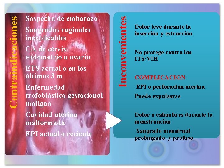 Sangrados vaginales inexplicables CA de cérvix endometrio u ovario ETS actual o en los