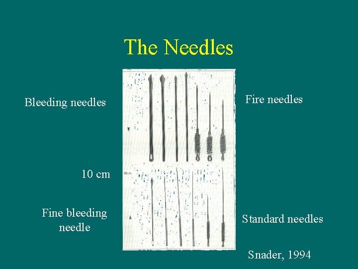 The Needles Bleeding needles Fire needles 10 cm Fine bleeding needle Standard needles Snader,