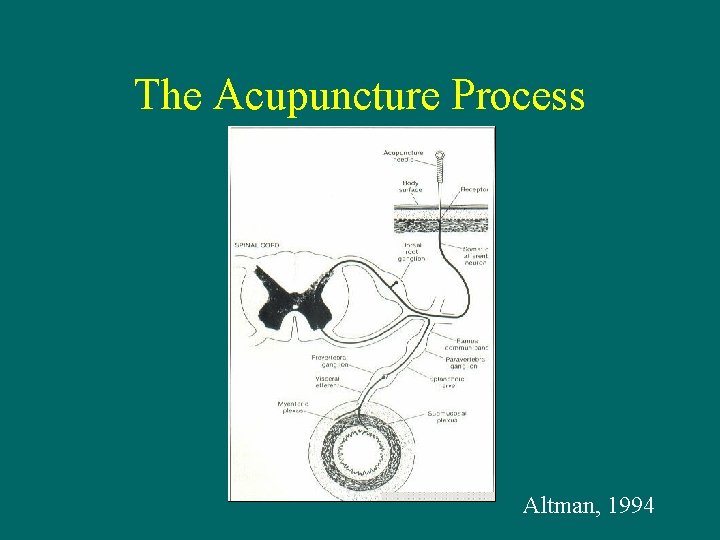 The Acupuncture Process Altman, 1994 