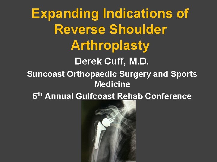 Expanding Indications of Reverse Shoulder Arthroplasty Derek Cuff, M. D. Suncoast Orthopaedic Surgery and