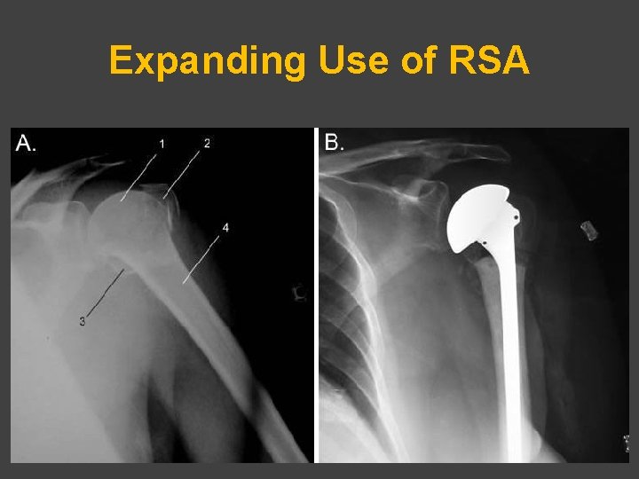 Expanding Use of RSA 