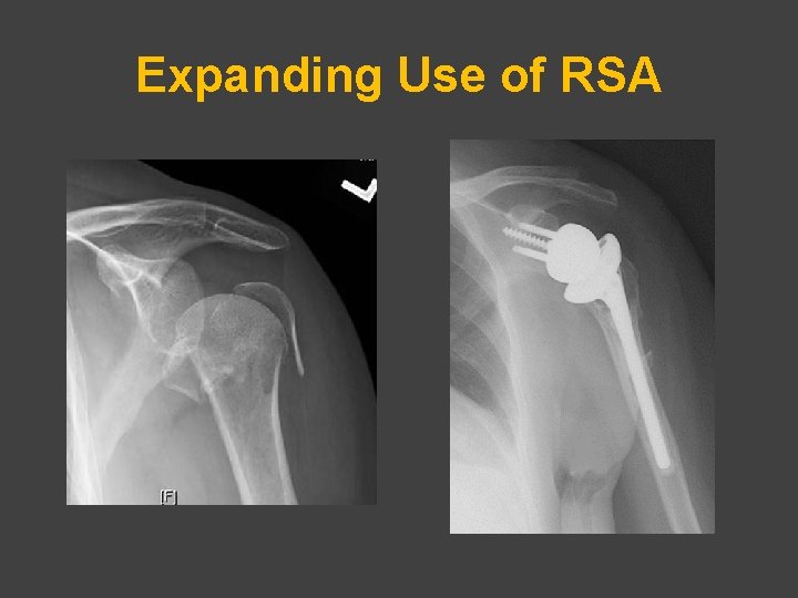 Expanding Use of RSA 