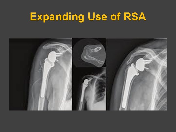 Expanding Use of RSA 