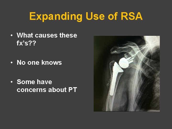 Expanding Use of RSA • What causes these fx’s? ? • No one knows