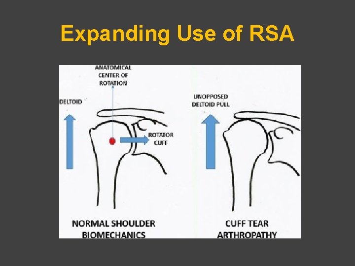 Expanding Use of RSA 