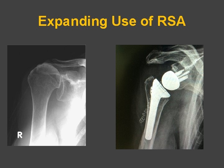 Expanding Use of RSA 