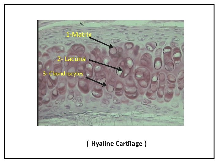 1 -Matrix 2 - Lacuna 3 - Chondrocytes ( Hyaline Cartilage ) 